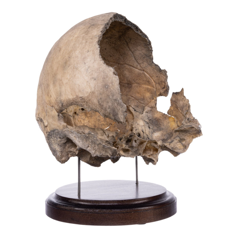 Real Human Partial Skull on Stand
