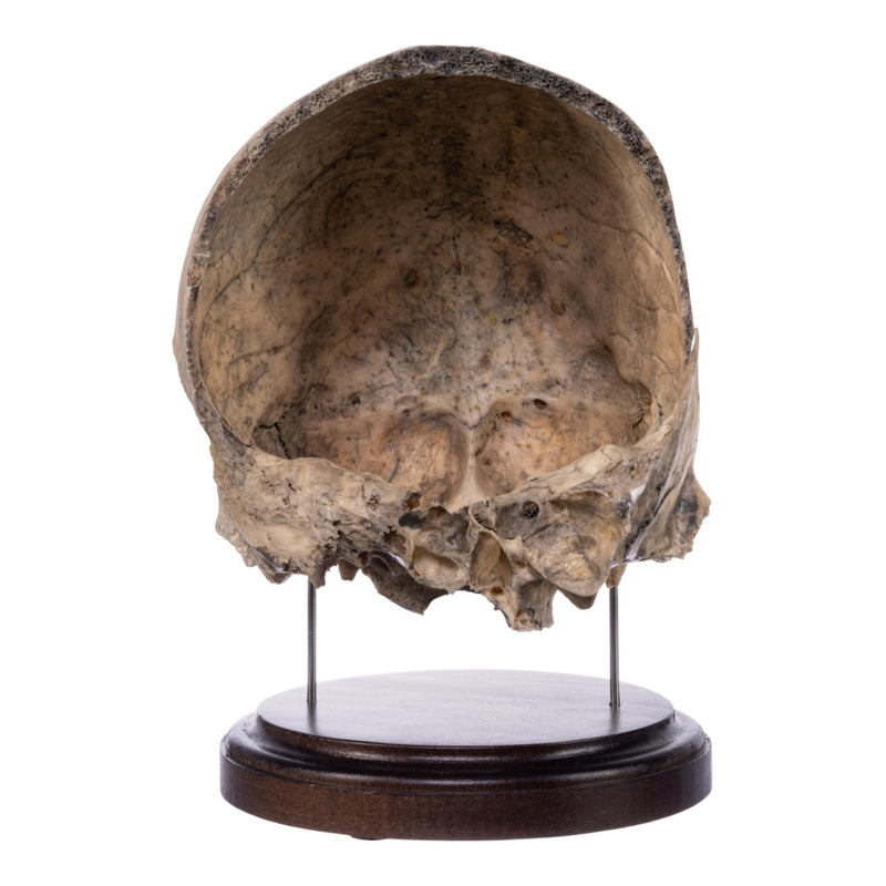 Real Human Partial Skull on Stand
