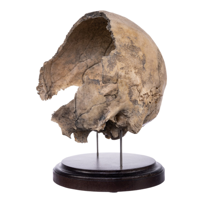 Real Human Partial Skull on Stand