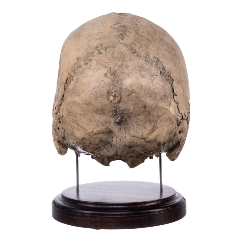 Real Human Partial Skull on Stand