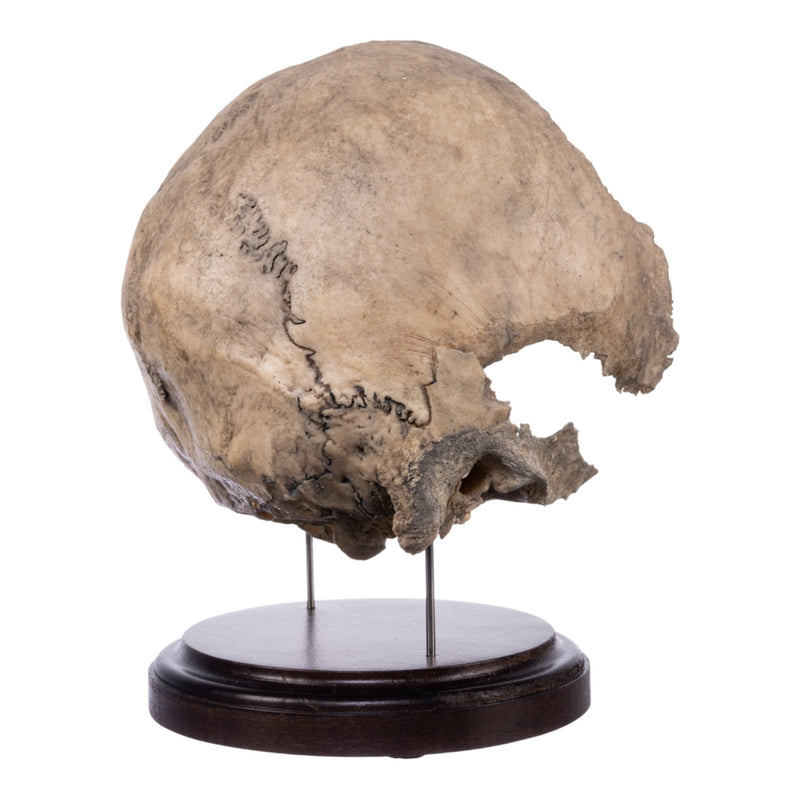 Real Human Partial Skull on Stand