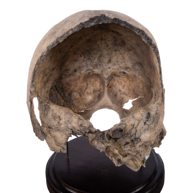 Real Human Partial Skull on Stand