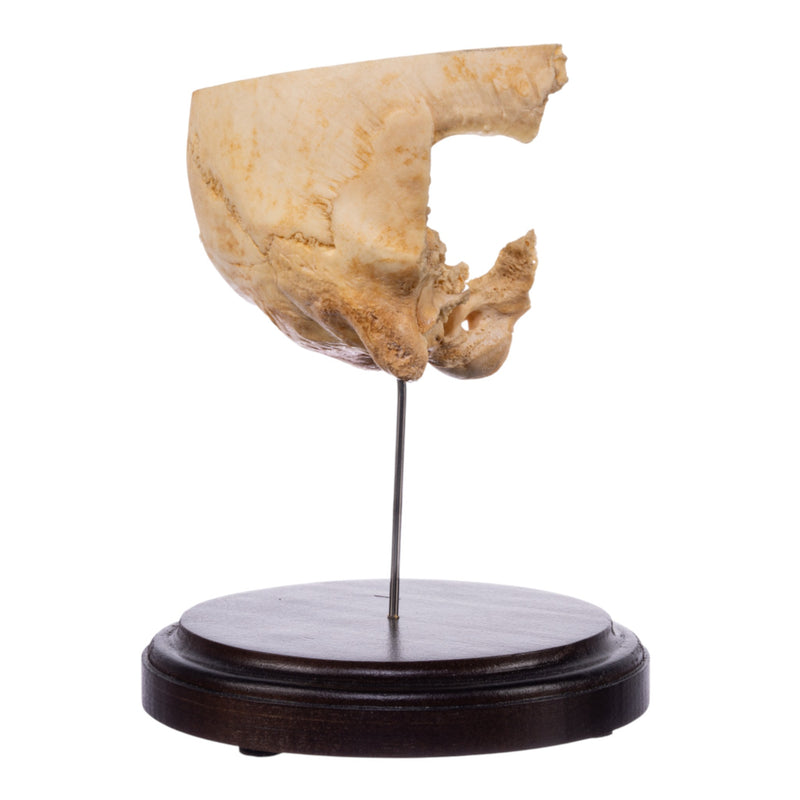 Real Human Partial Skull on Stand