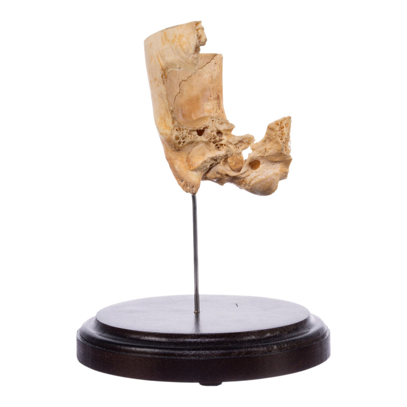 Real Human Partial Skull on Stand