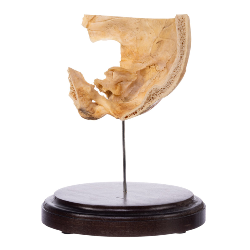 Real Human Partial Skull on Stand