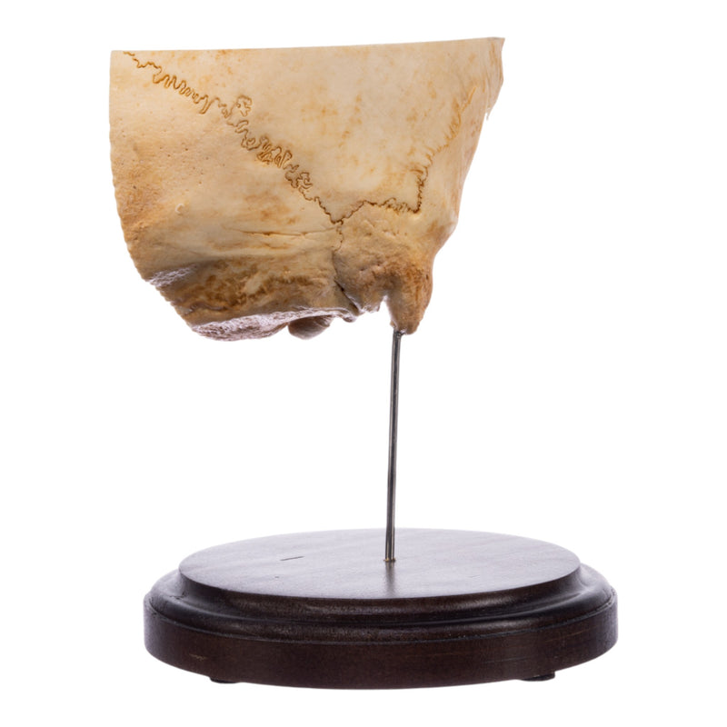Real Human Partial Skull on Stand
