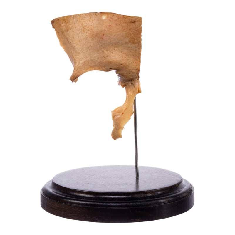 Real Human Partial Skull on Stand