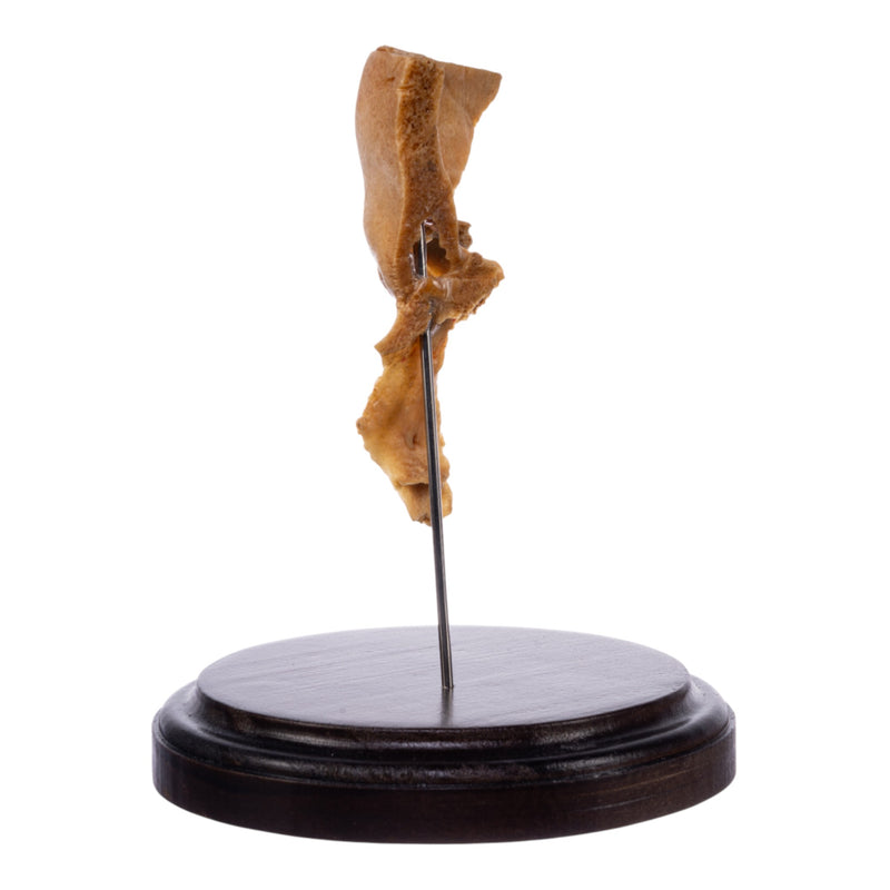 Real Human Partial Skull on Stand
