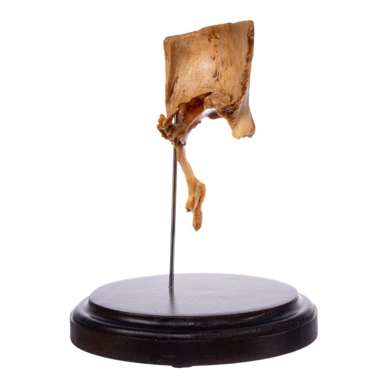 Real Human Partial Skull on Stand