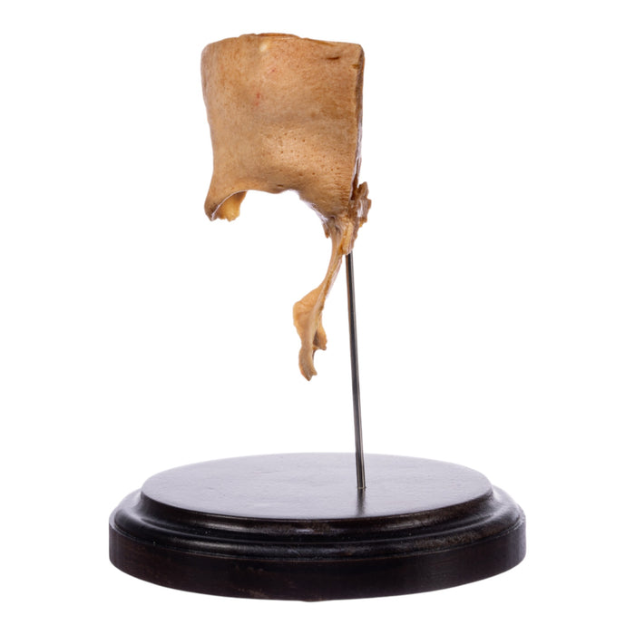 Real Human Partial Skull on Stand