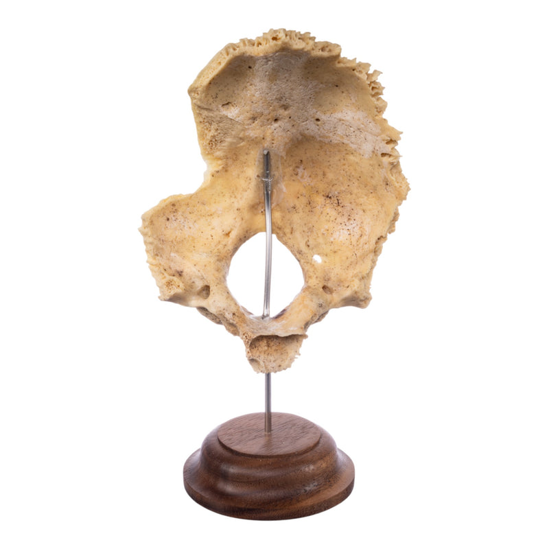 Real Human Partial Skull on Stand