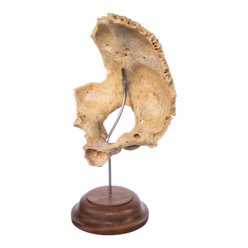 Real Human Partial Skull on Stand