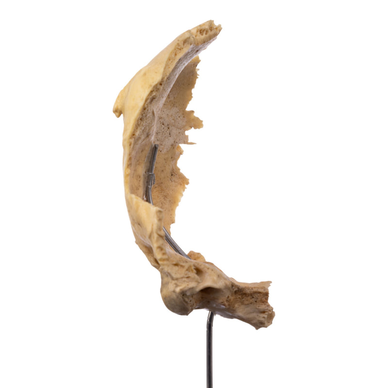 Real Human Partial Skull on Stand