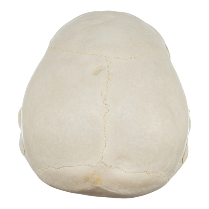 Real Chacma Baboon Skull - Adolescent Male (Damaged)