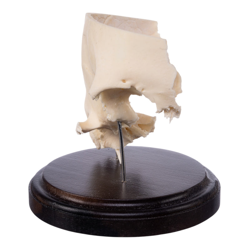 Real Human Partial Skull on Stand
