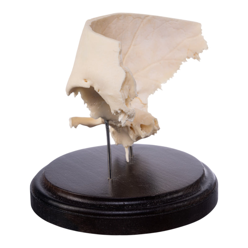 Real Human Partial Skull on Stand