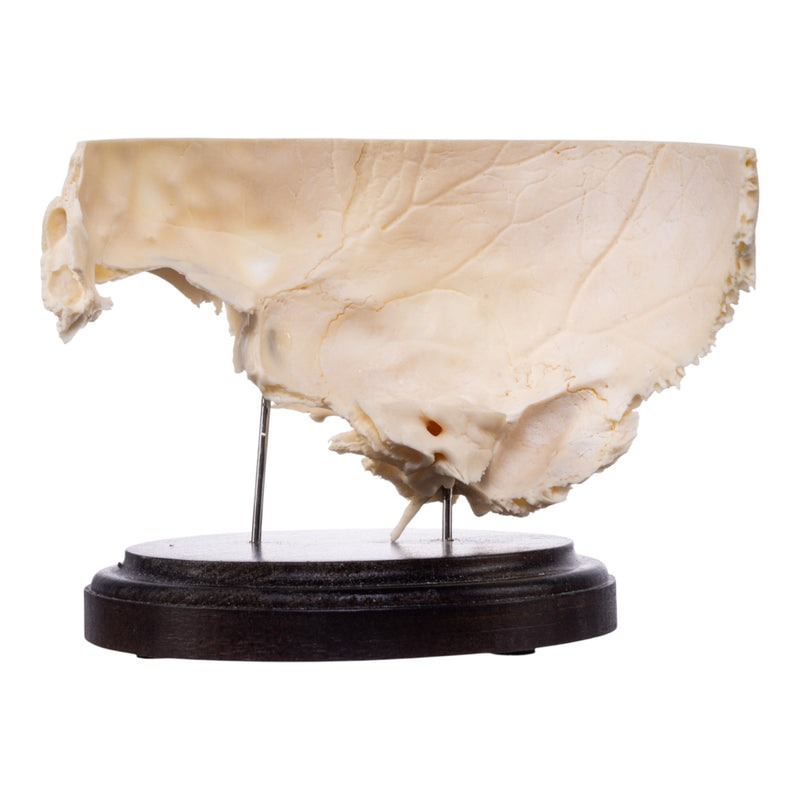 Real Human Partial Skull on Stand