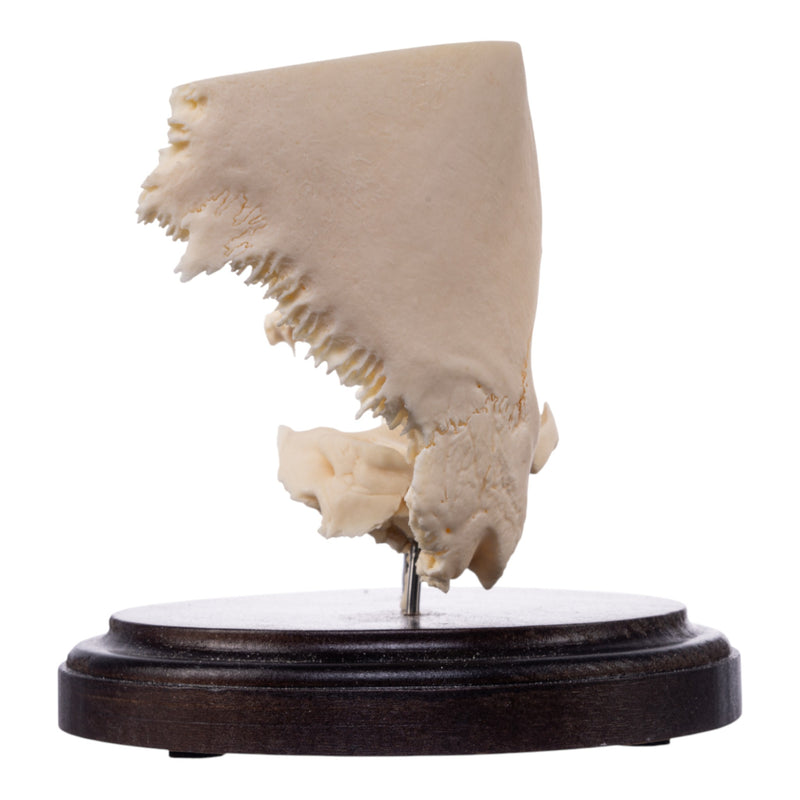 Real Human Partial Skull on Stand