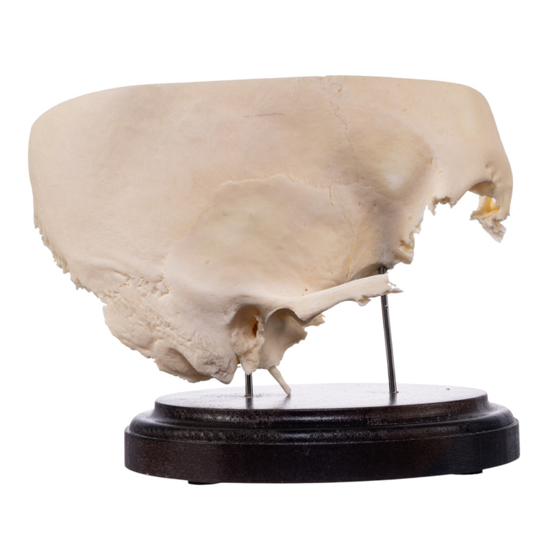 Real Human Partial Skull on Stand