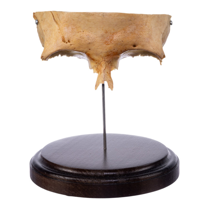 Real Human Partial Skull on Stand