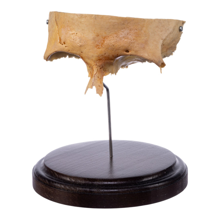 Real Human Partial Skull on Stand