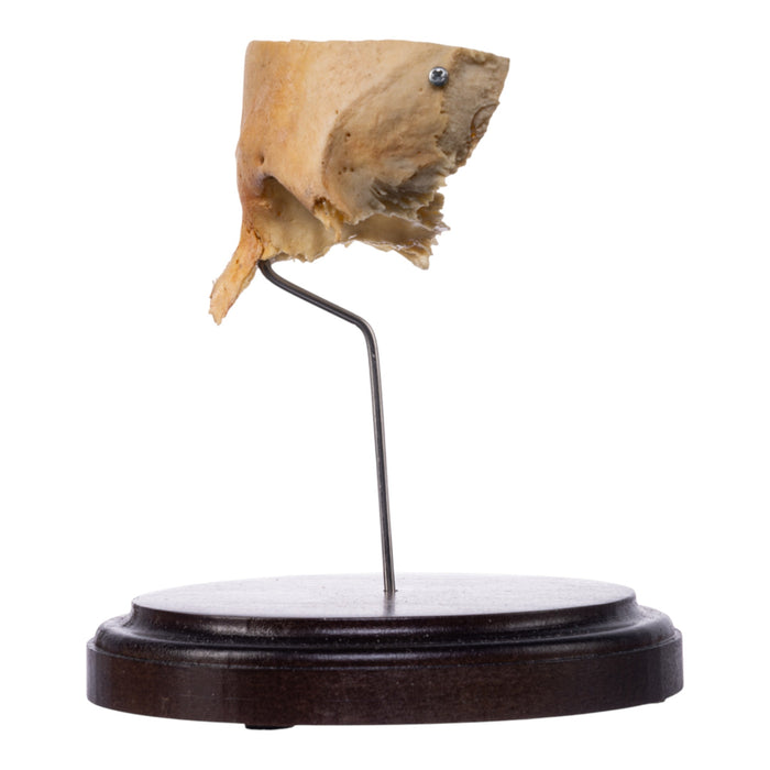 Real Human Partial Skull on Stand