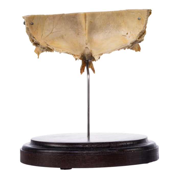 Real Human Partial Skull on Stand