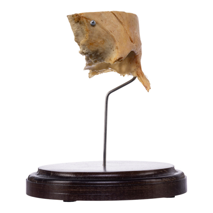 Real Human Partial Skull on Stand