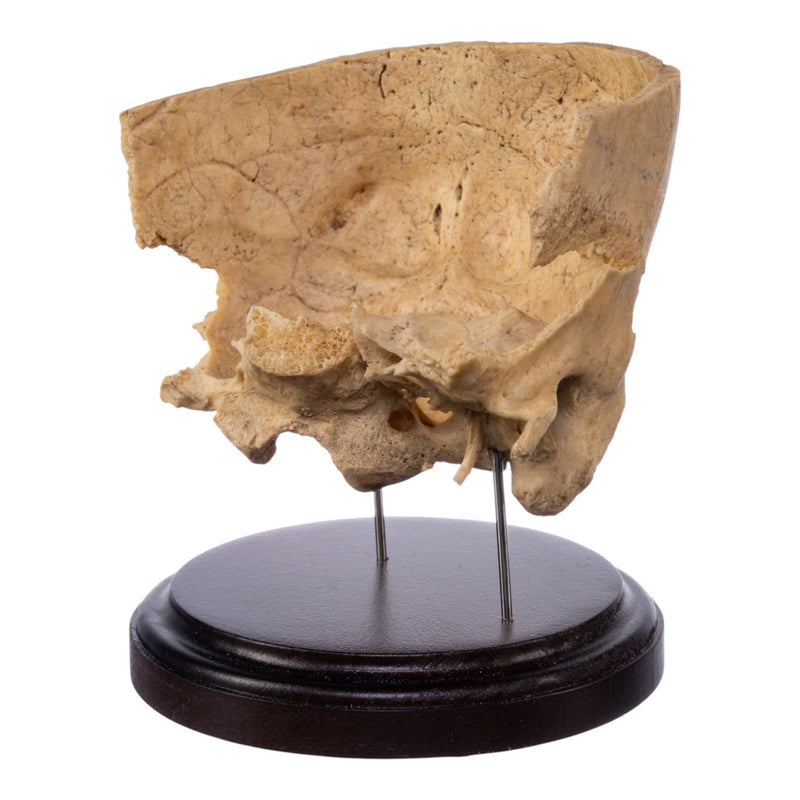 Real Human Partial Skull on Stand