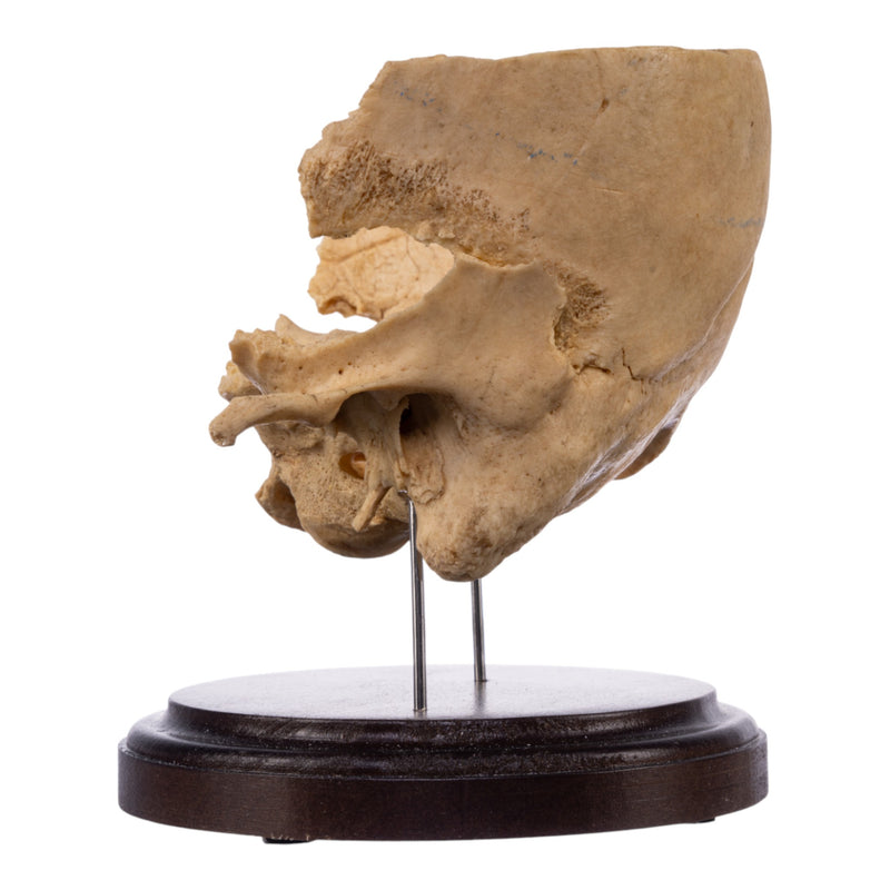 Real Human Partial Skull on Stand