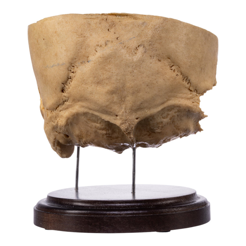 Real Human Partial Skull on Stand