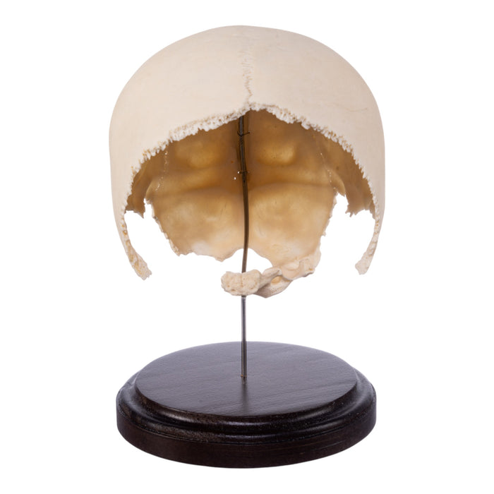 Real Human Partial Skull on Stand