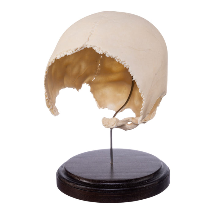 Real Human Partial Skull on Stand