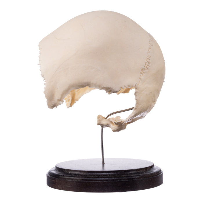 Real Human Partial Skull on Stand