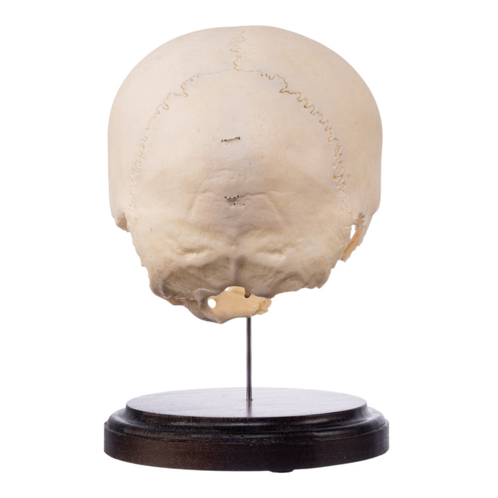 Real Human Partial Skull on Stand
