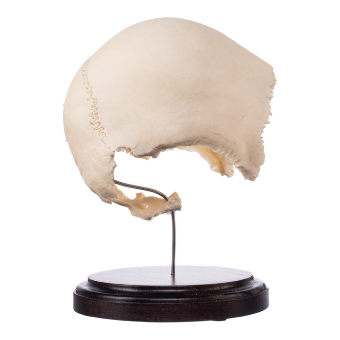 Real Human Partial Skull on Stand