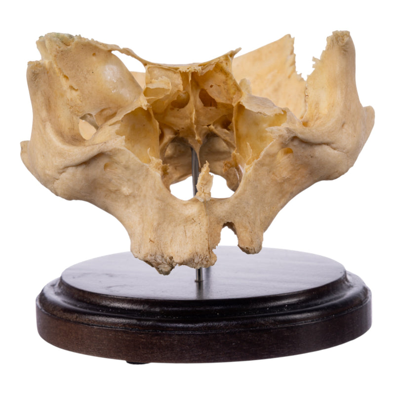 Real Human Partial Skull on Stand