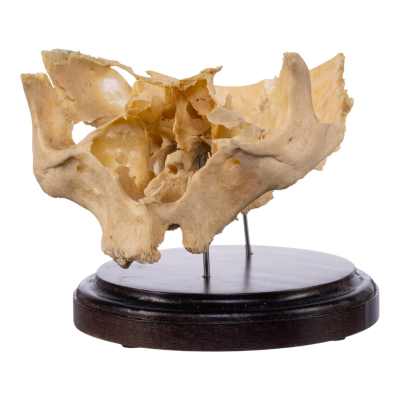 Real Human Partial Skull on Stand