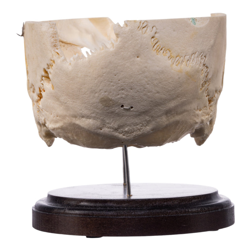 Real Human Partial Skull on Stand