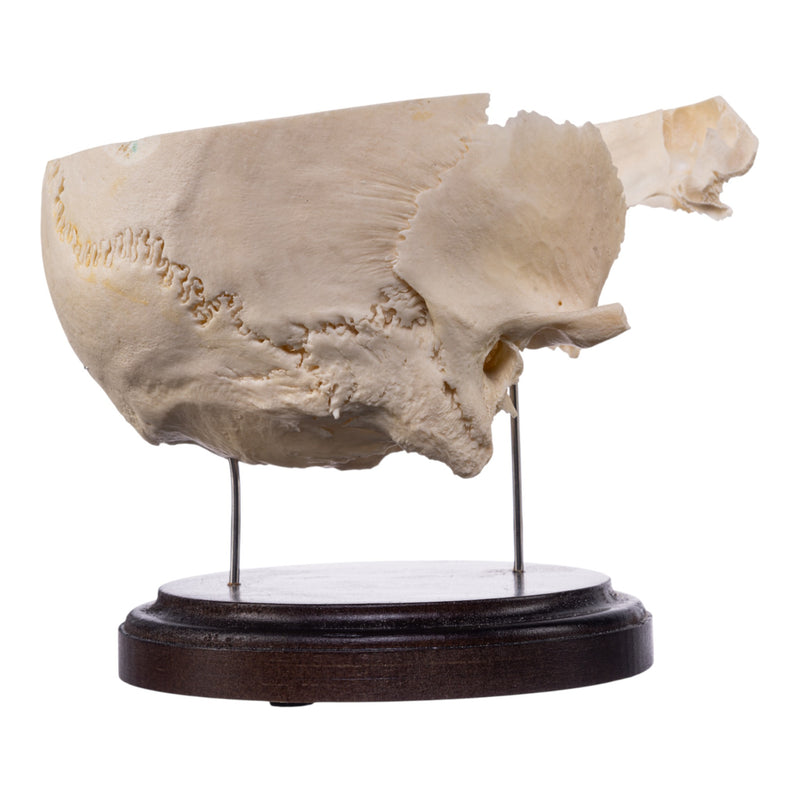 Real Human Partial Skull on Stand
