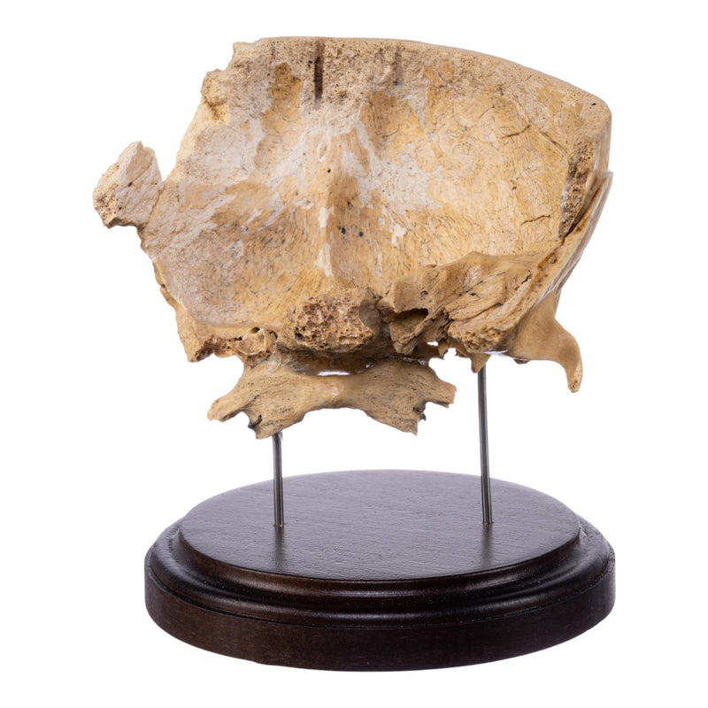 Real Human Partial Skull on Stand