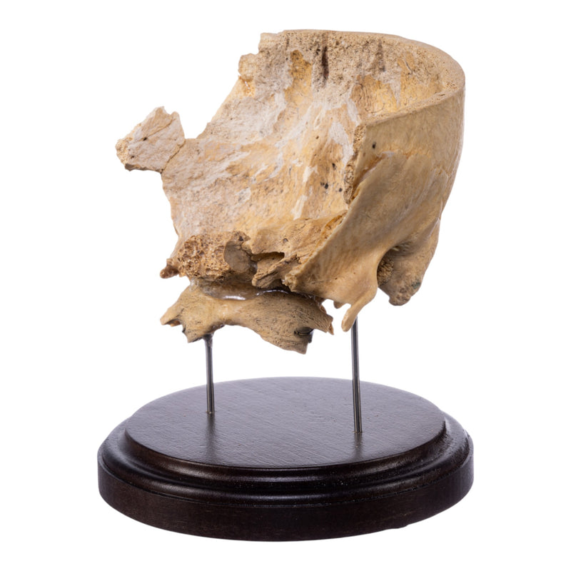 Real Human Partial Skull on Stand
