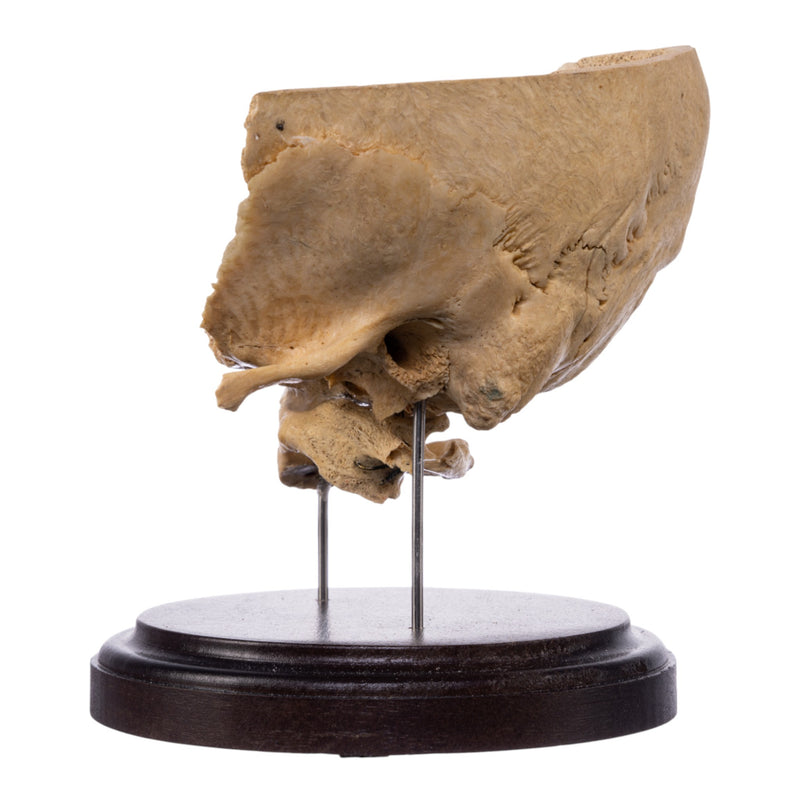 Real Human Partial Skull on Stand