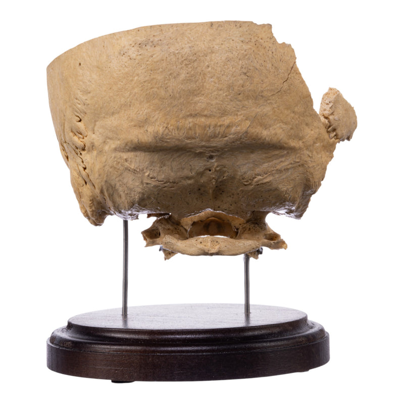 Real Human Partial Skull on Stand