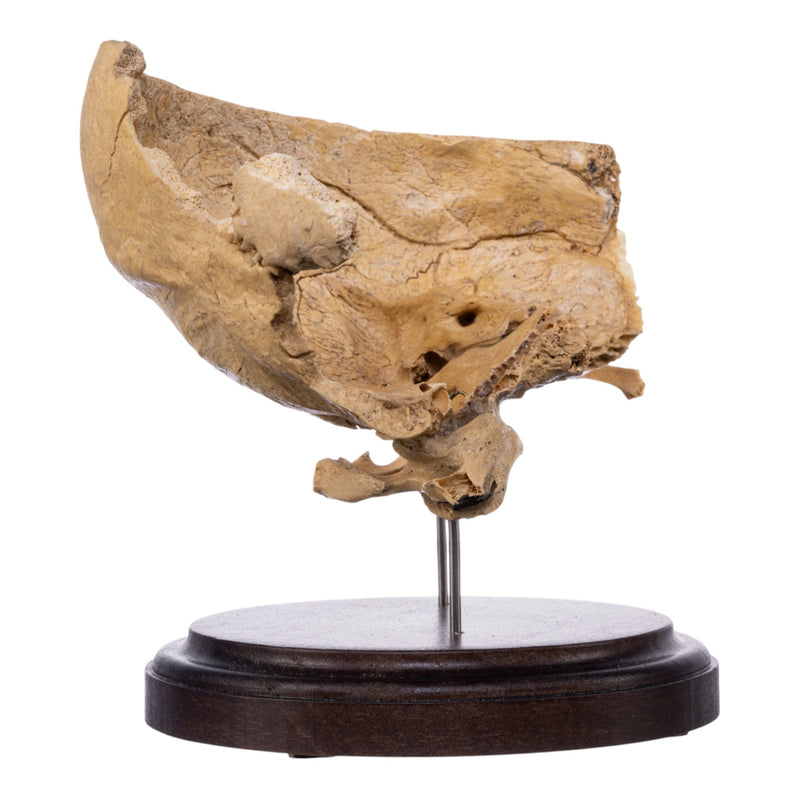 Real Human Partial Skull on Stand