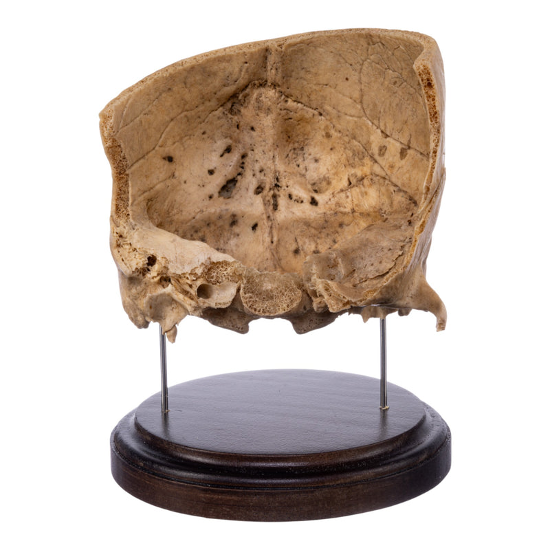 Real Human Partial Skull on Stand