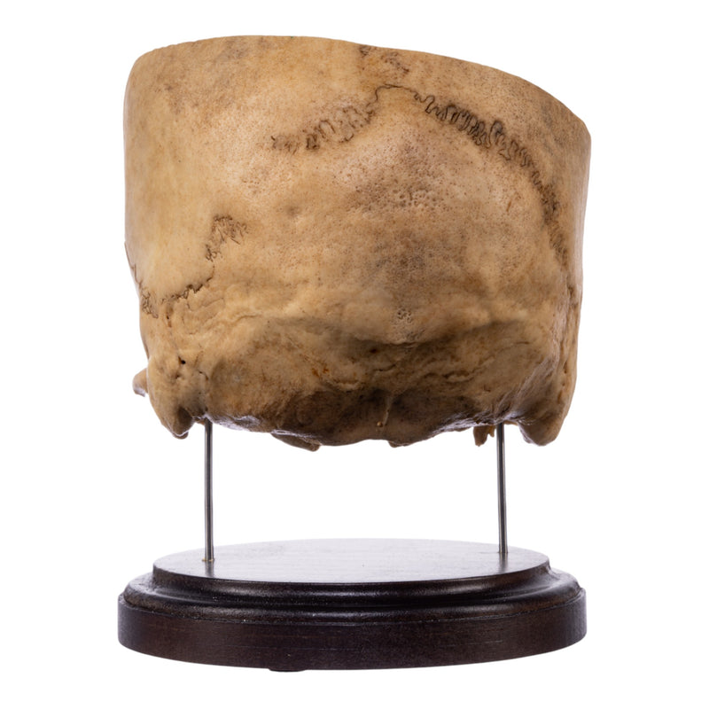 Real Human Partial Skull on Stand