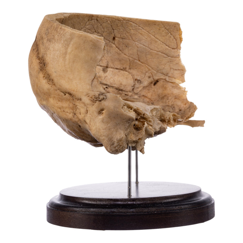 Real Human Partial Skull on Stand