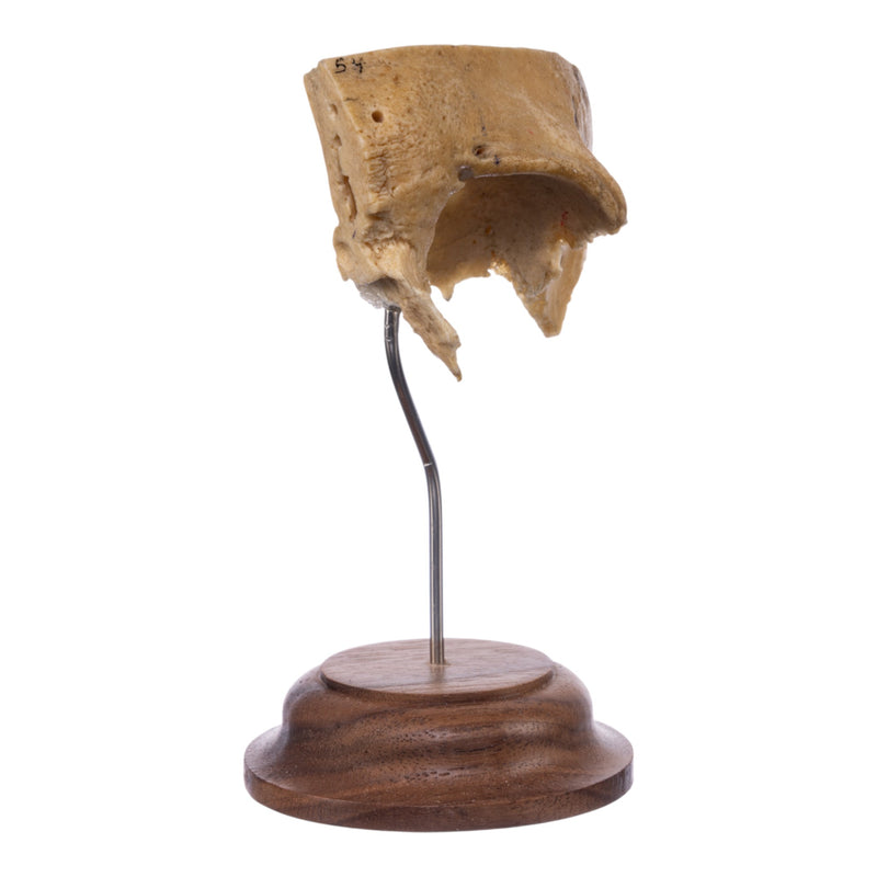 Real Human Partial Skull on Stand