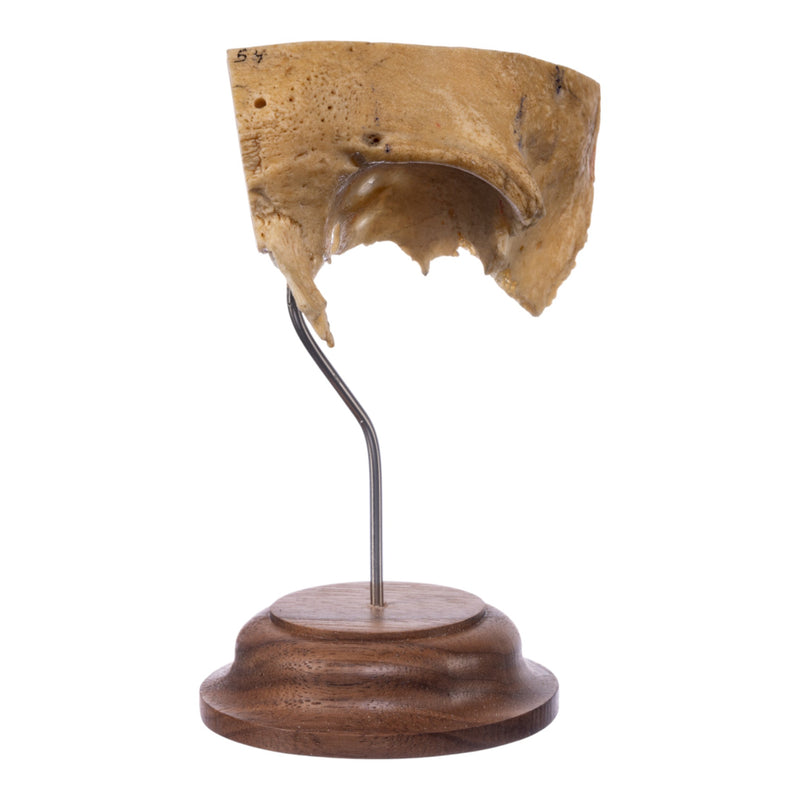 Real Human Partial Skull on Stand